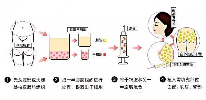 人工合成乳胶的危害